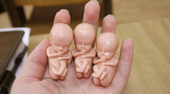 Így néz ki a 10 hetes, még abortálható magzat
